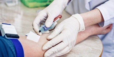 Cost of Blood Test Without Insurance in 2022