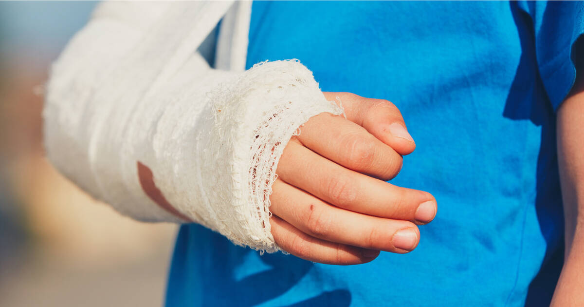 common-types-of-broken-bones-in-children-kidsstreet