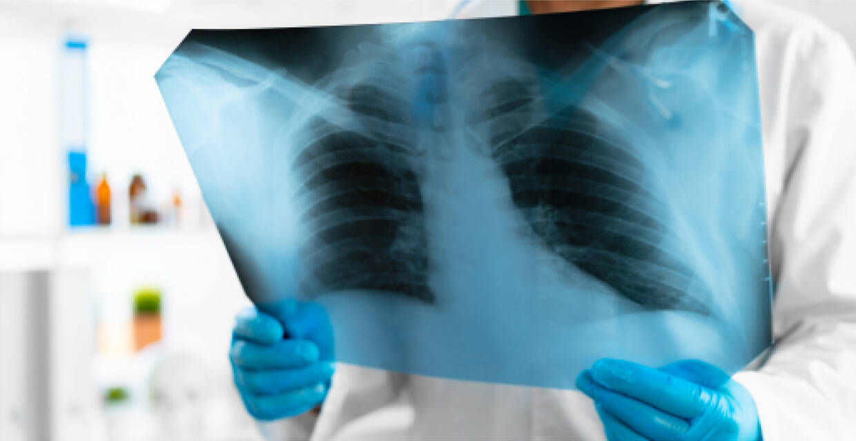 X-Rays at Urgent Care: What You Need to Know
