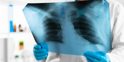 X-Rays at Urgent Care: What You Need to Know