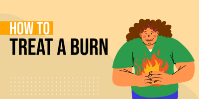 14 Ways to Treat a Burn: First-aid tips (and when to see a doctor)