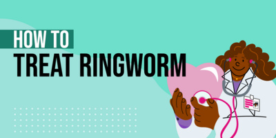 How to Prevent & Treat Ringworm at Home