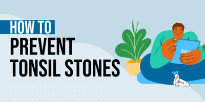 How to Prevent & Treat Tonsil Stones