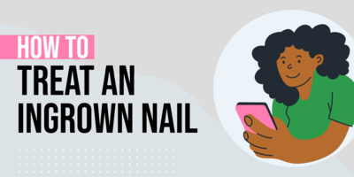 How to Treat an Ingrown Toenail: 5 Toe-tally Effective Ways