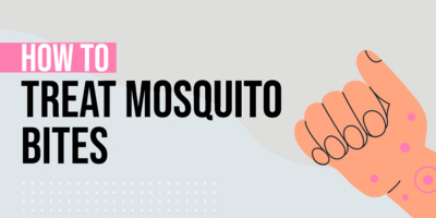 How to Treat Mosquito Bites: 13 Itch-Stopping Tips