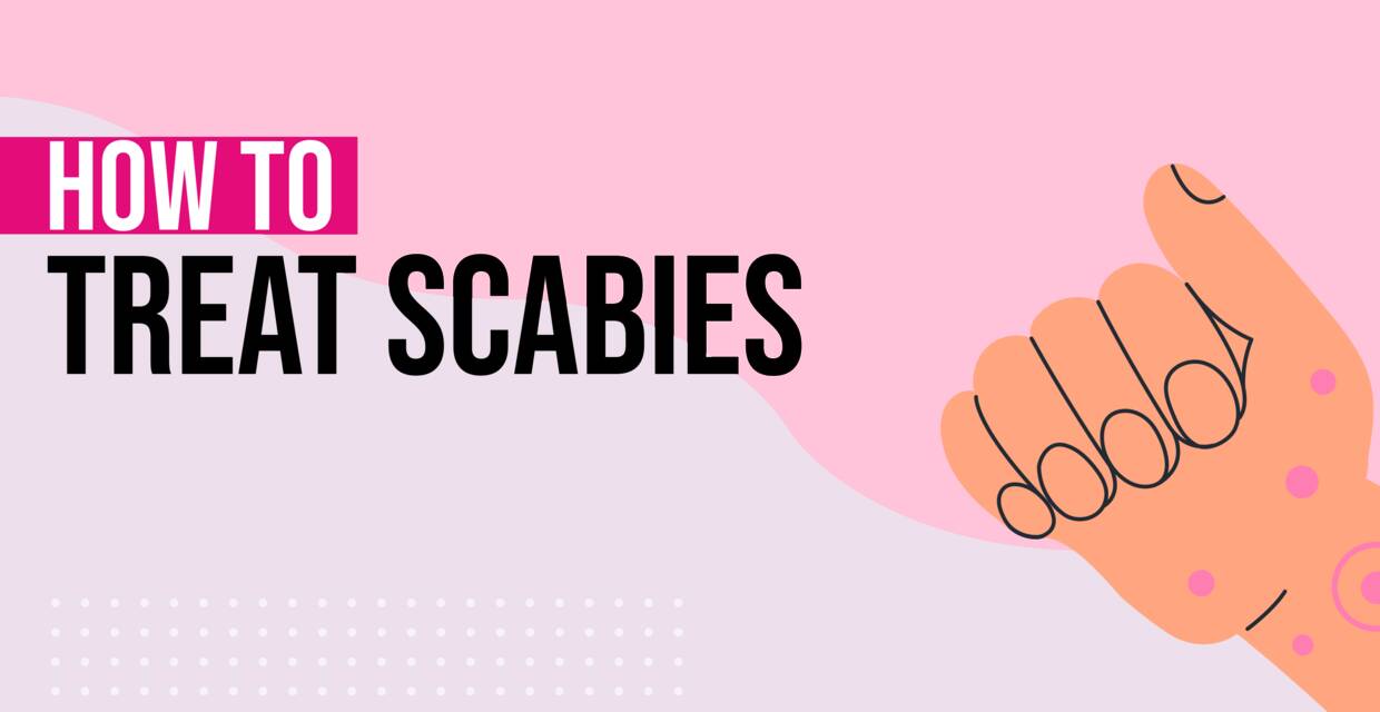How to Treat Scabies