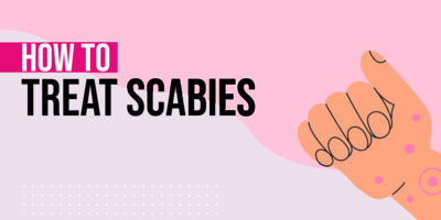 How to Treat Scabies