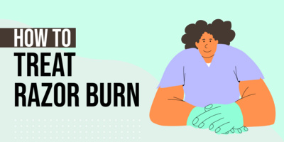 How to Treat Razor Burn