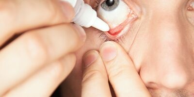 What Are Eye Allergies? Symptoms, Causes, and Treatment