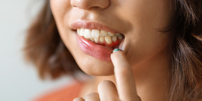 What Is Gingivitis (Gum Disease)?