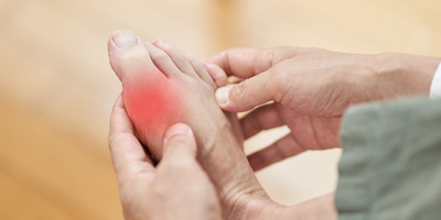 Gout: Tests, Treatment and Diagnosis