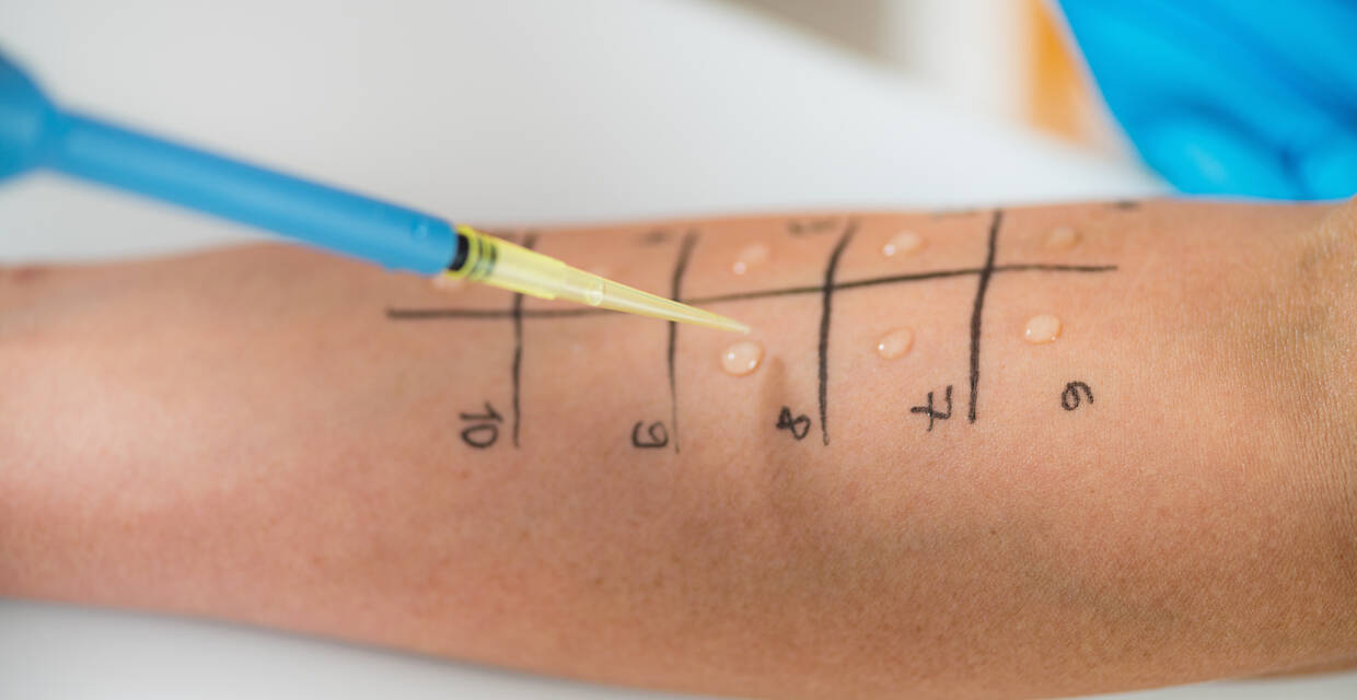 Allergy Testing Basics: Purpose, Types and Meaning