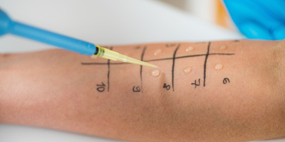 Allergy Testing Basics: Purpose, Types and Meaning