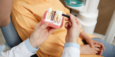 Dental Implant 101: A Comprehensive Guide