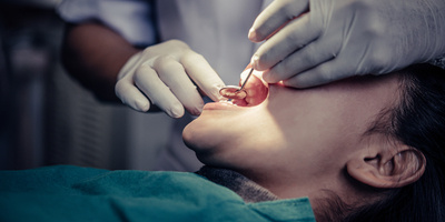 Dental Abscess: Symptoms and Treatment