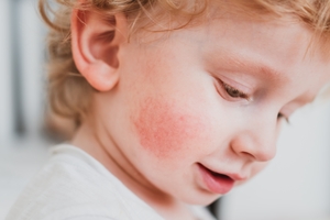 When to Worry About a Rash in Adults: A Symptoms Guide