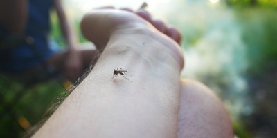 Skeeter Syndrome: Mosquito Bite Allergy Symptoms & Treatment